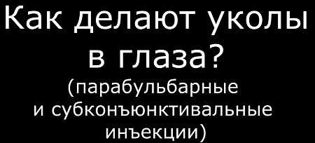 Видео уколов в глаза - парабульбарные и субконъюнктивальные инъекции