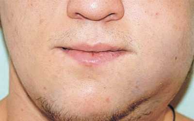 Виды патологии - Стоматология «Линия Улыбки»