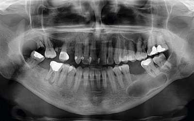Симптомы заболевания - Стоматология «Линия Улыбки»