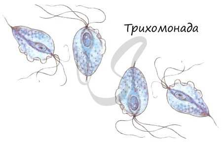 Трихомонада