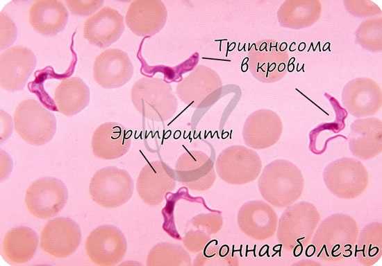 Трипаносома, сонная болезнь
