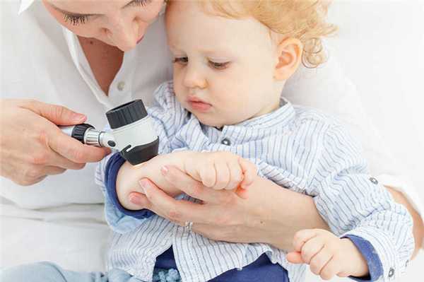 Бородавки: причины и типы