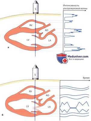 Режимы эхокардиографии (виды изображений ЭхоКГ)