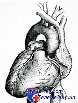 протезировани аортального клапана