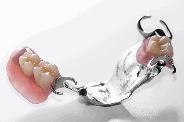 Бюгельный протез зубов