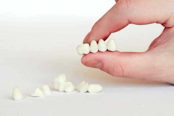 Мостовидные протезы