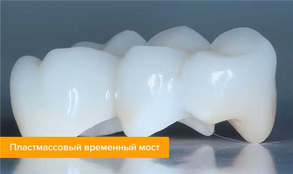  Фото пластмассового временного моста