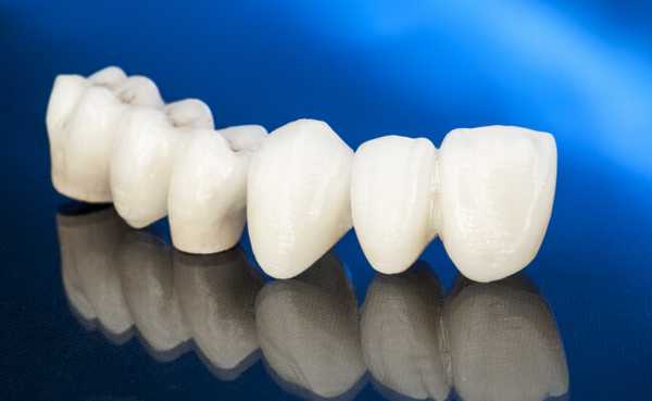 Фото циркониевого протеза