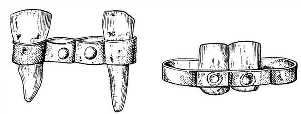Древние зубные протезы изготавливались из дерева или кости и фиксировались во рту с помощью металлической проволоки либо полосок.