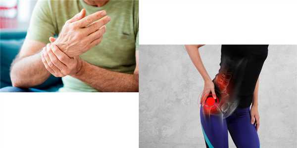 Симптомы реактивного артрита