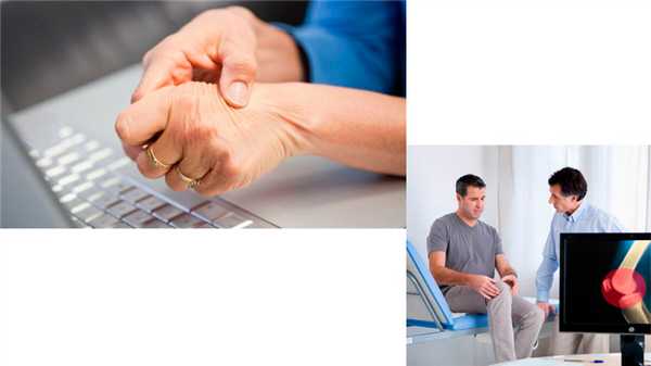 Диагностика ревматроидного артрита