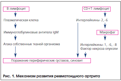 Рис. 1. Механизм развития ревматоидного артрита