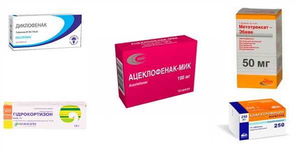 Лечение артрита