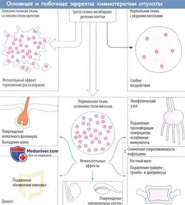 Основные и побочные эффекты химиотерапии опухоли