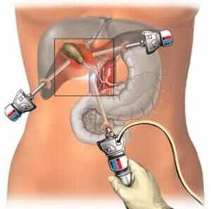 Проведение операции