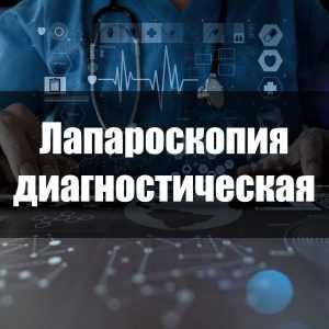 Лапароскопия диагностическая