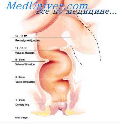 пластические операции в проктологии
