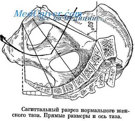 размеры таза