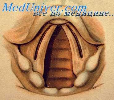ларингоскопия