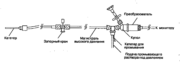 Мониторинг инвазивного артериального давления: практические аспекты