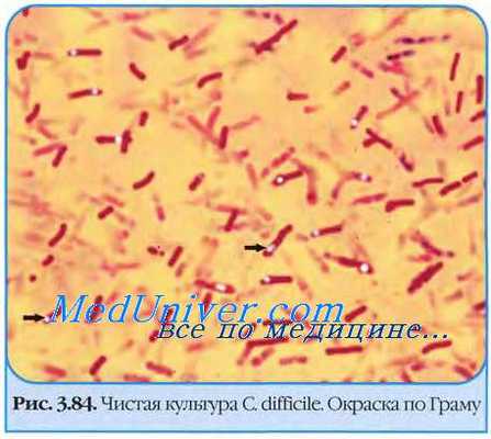 возбудитель псевдомембранозного колита - Clostridium difficile