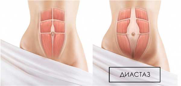 суть проблемы