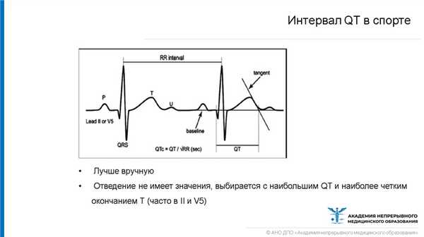 Интервал QT в спорте