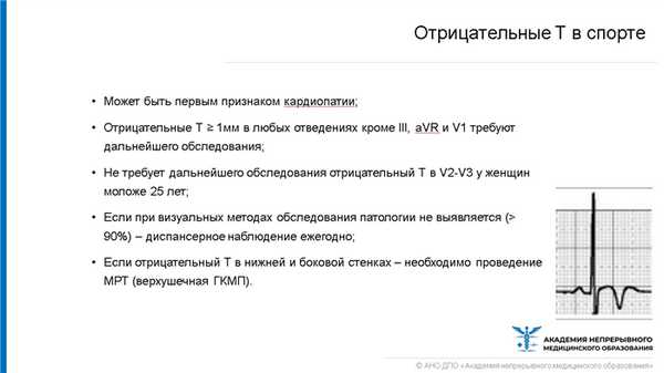 Отрицательные T в спорте