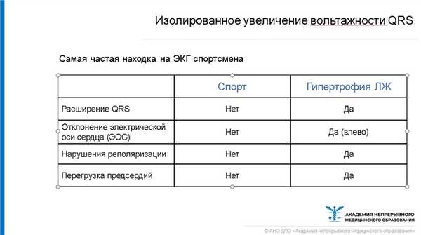 Изолированное увеличение вольтажности QRS