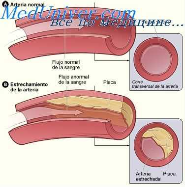 пульсативность артерий