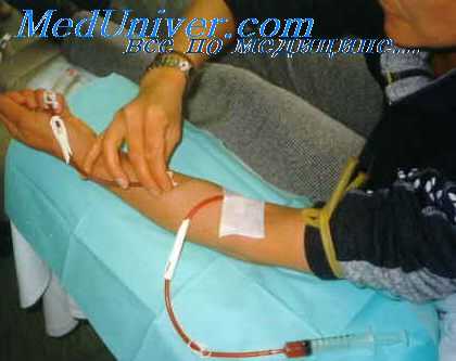 венопункция