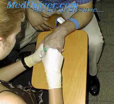 пункция бедренной вены