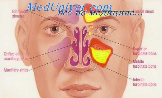 диафаноскопия пазух носа