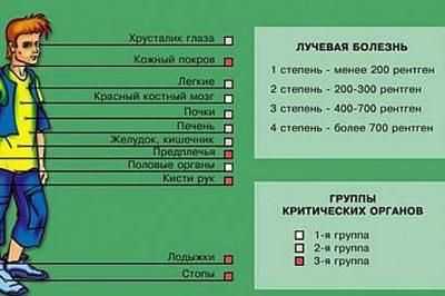 Признаки лучевой болезни