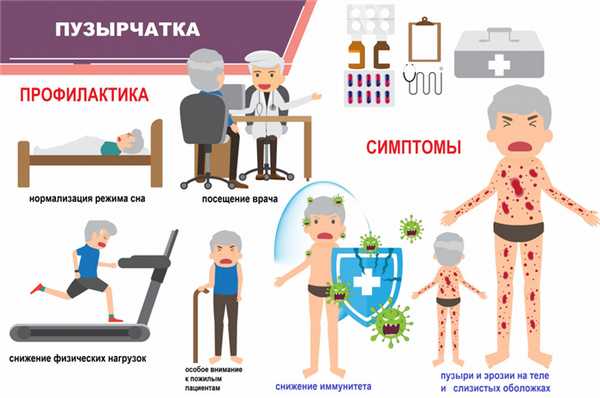 Вульгарная пузырчатка