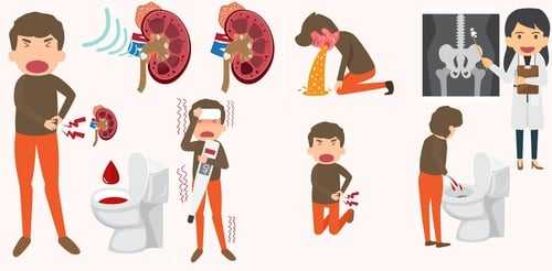 Симптомы боли в почках