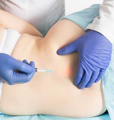 Уколы при радикулите