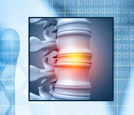 Хондропротекторы