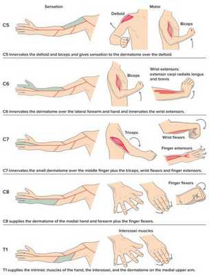 Лечебная физкультура при радикулите
