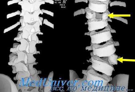 компьютерная томография костей