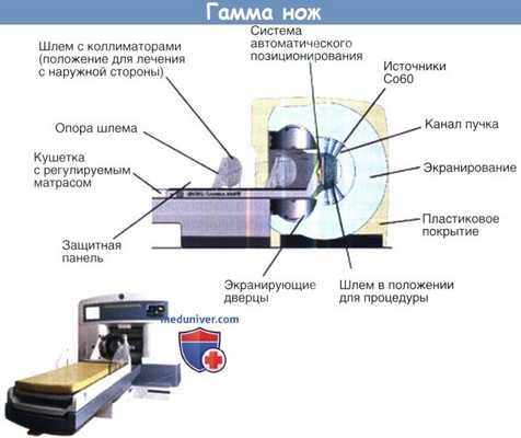Гамма нож