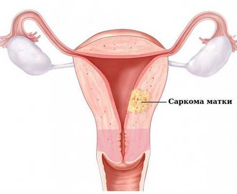 Ильин Антон Алексеевич, гинеколог, гинеколог-хирург, онколог, онколог-гинеколог, хирург - Санкт-Петербург