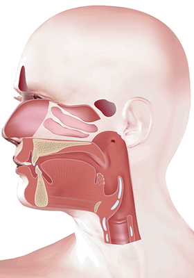 Рак ротоглотки
