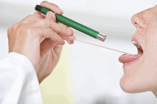 Рак миндалин