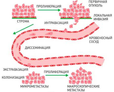 как возникают метастазы