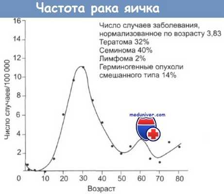 Прогноз рака яичников