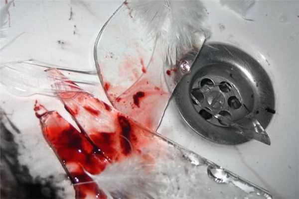 Порез стеклом