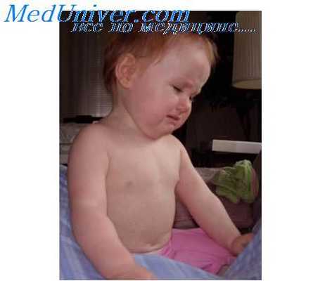 выявление несовместимости по резус фактору