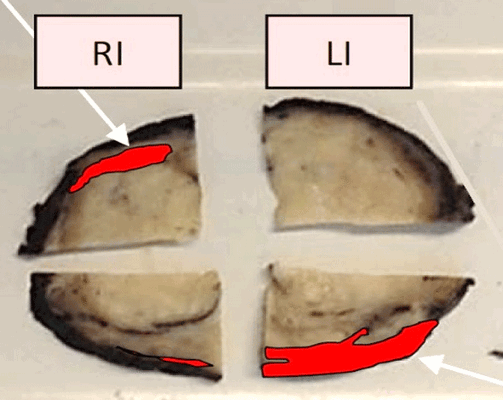 ultrazvukovoe issledovanie s elastografiej 04