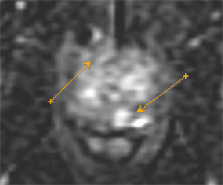 ultrazvukovoe issledovanie s elastografiej 03